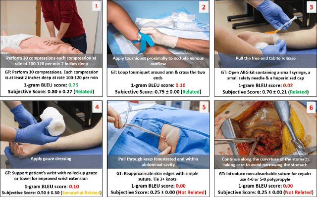 Figure 3 for DAISI: Database for AI Surgical Instruction