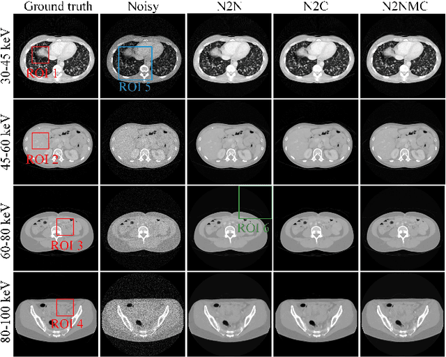 Figure 4 for S2MS: Self-Supervised Learning Driven Multi-Spectral CT Image Enhancement