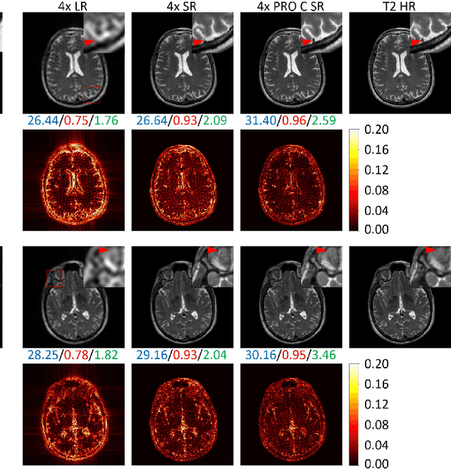 Figure 2 for Multi-Contrast Super-Resolution MRI Through a Progressive Network