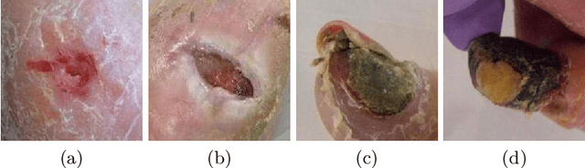 Figure 3 for Diabetic Foot Ulcer Grand Challenge 2021: Evaluation and Summary
