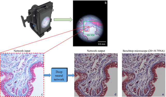 Figure 1 for Deep learning enhanced mobile-phone microscopy