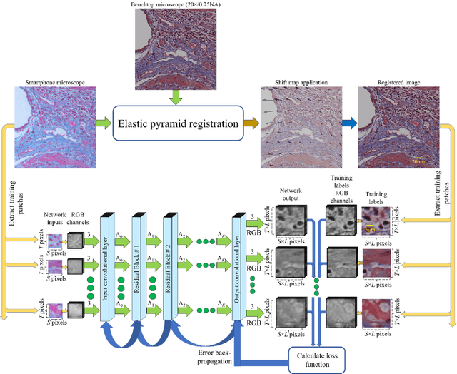 Figure 3 for Deep learning enhanced mobile-phone microscopy
