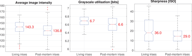 Figure 1 for Presentation Attack Detection for Cadaver Iris