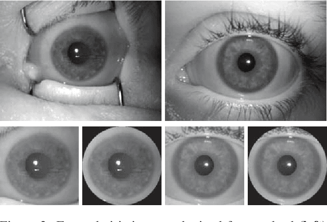 Figure 2 for Presentation Attack Detection for Cadaver Iris