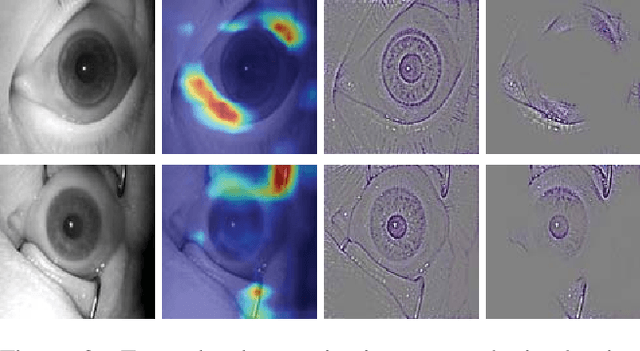 Figure 3 for Presentation Attack Detection for Cadaver Iris