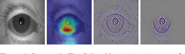 Figure 4 for Presentation Attack Detection for Cadaver Iris