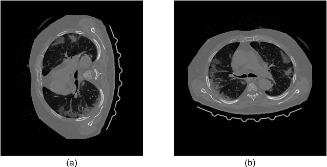 Figure 1 for A Deep-Learning Framework for Improving COVID-19 CT Image Quality and Diagnostic Accuracy