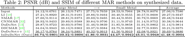 Figure 4 for InDuDoNet: An Interpretable Dual Domain Network for CT Metal Artifact Reduction
