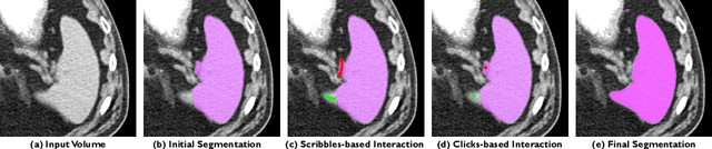 Figure 1 for MONAI Label: A framework for AI-assisted Interactive Labeling of 3D Medical Images