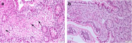 Figure 3 for Diagnosis of Paratuberculosis in Histopathological Images Based on Explainable Artificial Intelligence and Deep Learning