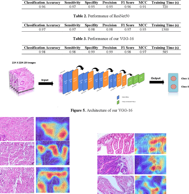 Figure 4 for Diagnosis of Paratuberculosis in Histopathological Images Based on Explainable Artificial Intelligence and Deep Learning
