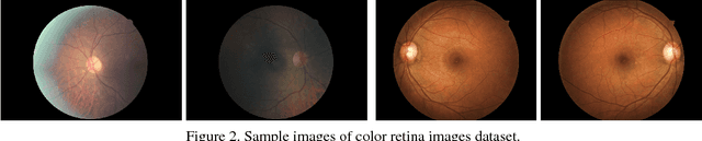 Figure 3 for Diabetic Retinopathy Detection via Deep Convolutional Networks for Discriminative Localization and Visual Explanation
