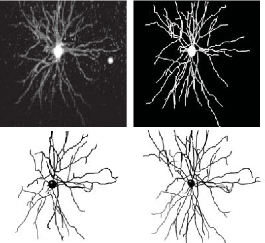 Figure 2 for Reconstructing neuronal anatomy from whole-brain images