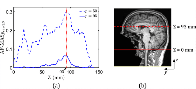 Figure 3 for Data-driven Uncertainty Quantification in Computational Human Head Models