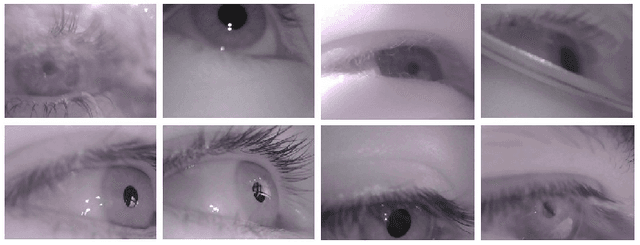 Figure 1 for ESCaF: Pupil Centre Localization Algorithm with Candidate Filtering