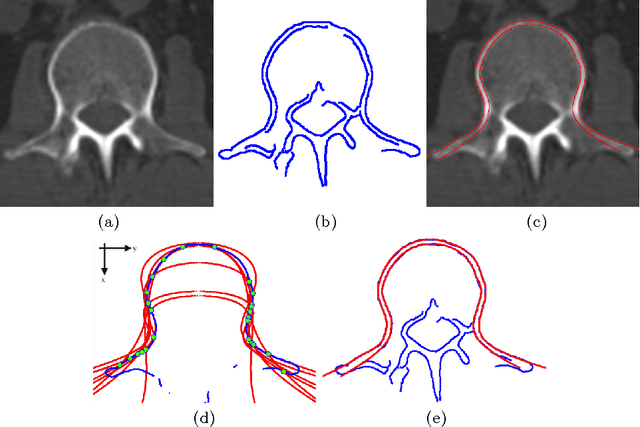Figure 2 for An iterative approach to Hough transform without re-voting