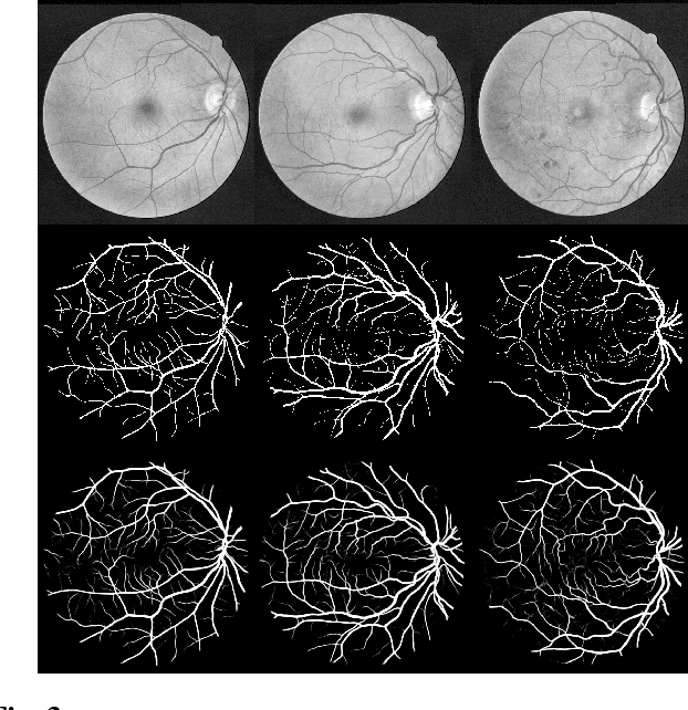 Figure 4 for LadderNet: Multi-path networks based on U-Net for medical image segmentation