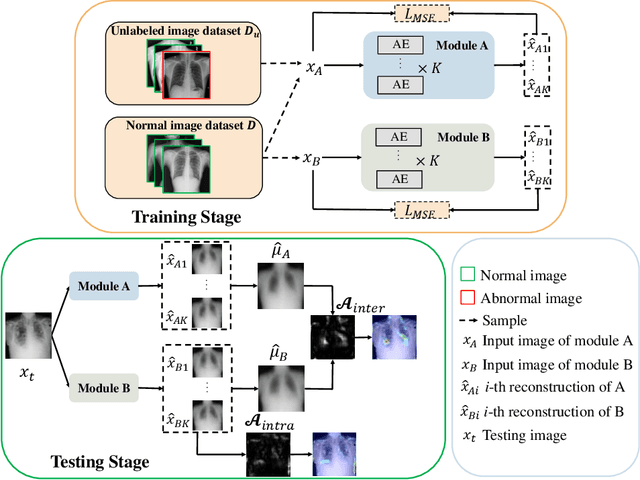 Figure 1 for Dual-Distribution Discrepancy for Anomaly Detection in Chest X-Rays