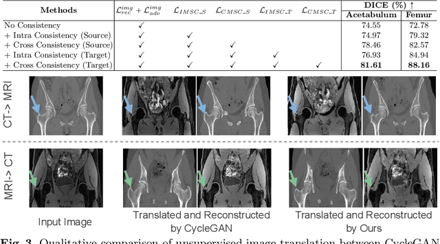 Figure 3 for ICMSC: Intra- and Cross-modality Semantic Consistency for Unsupervised Domain Adaptation on Hip Joint Bone Segmentation