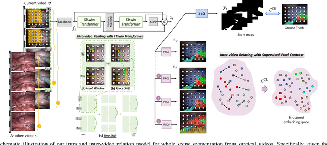 Figure 2 for Exploring Intra- and Inter-Video Relation for Surgical Semantic Scene Segmentation