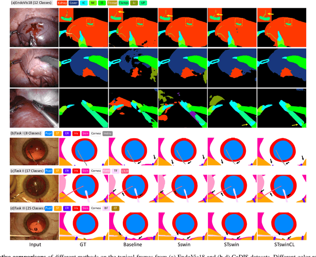 Figure 3 for Exploring Intra- and Inter-Video Relation for Surgical Semantic Scene Segmentation