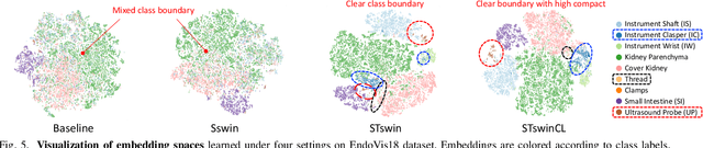 Figure 4 for Exploring Intra- and Inter-Video Relation for Surgical Semantic Scene Segmentation