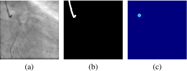 Figure 3 for Dynamic Coronary Roadmapping via Catheter Tip Tracking in X-ray Fluoroscopy with Deep Learning Based Bayesian Filtering