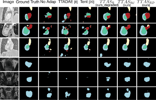 Figure 4 for Test-Time Adaptation with Shape Moments for Image Segmentation