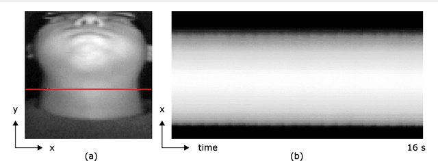 Figure 1 for Estimating Carotid Pulse and Breathing Rate from Near-infrared Video of the Neck