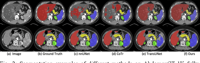 Figure 3 for A New Probabilistic V-Net Model with Hierarchical Spatial Feature Transform for Efficient Abdominal Multi-Organ Segmentation