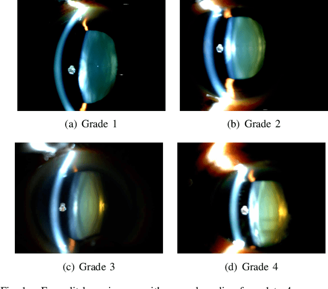 Figure 1 for Sparse Range-constrained Learning and Its Application for Medical Image Grading
