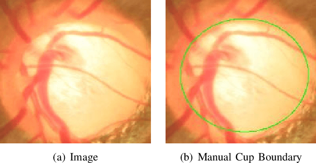 Figure 2 for Sparse Range-constrained Learning and Its Application for Medical Image Grading