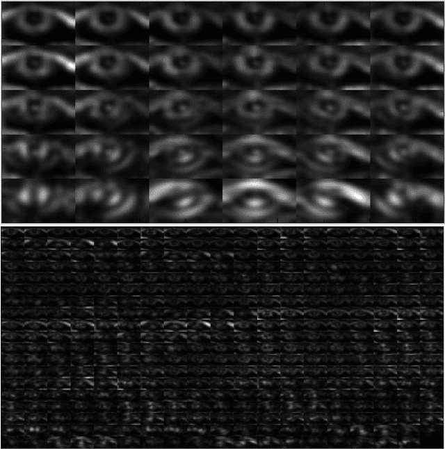 Figure 1 for DeepIris: Iris Recognition Using A Deep Learning Approach