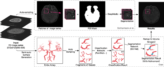 Figure 1 for Surface-based 3D Deep Learning Framework for Segmentation of Intracranial Aneurysms from TOF-MRA Images