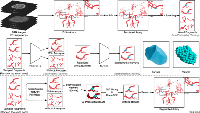 Figure 3 for Surface-based 3D Deep Learning Framework for Segmentation of Intracranial Aneurysms from TOF-MRA Images