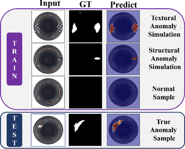 Figure 1 for MemSeg: A semi-supervised method for image surface defect detection using differences and commonalities
