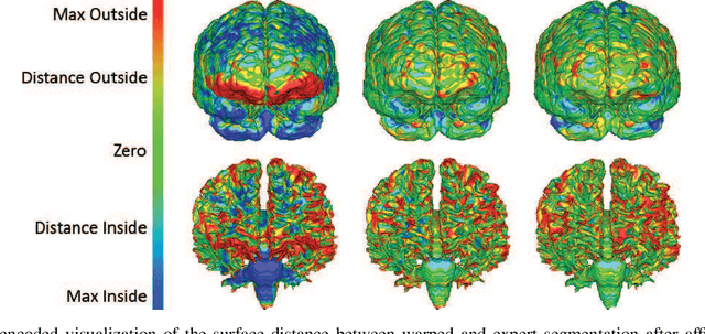 Figure 3 for Playing with Duality: An Overview of Recent Primal-Dual Approaches for Solving Large-Scale Optimization Problems