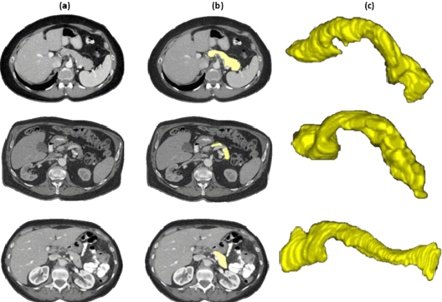 Figure 1 for A Bottom-Up Approach for Automatic Pancreas Segmentation in Abdominal CT Scans