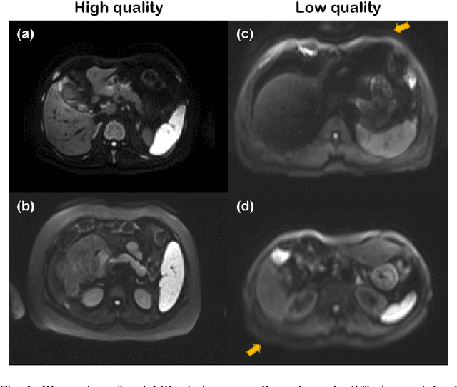 Figure 1 for Simultaneous super-resolution and motion artifact removal in diffusion-weighted MRI using unsupervised deep learning