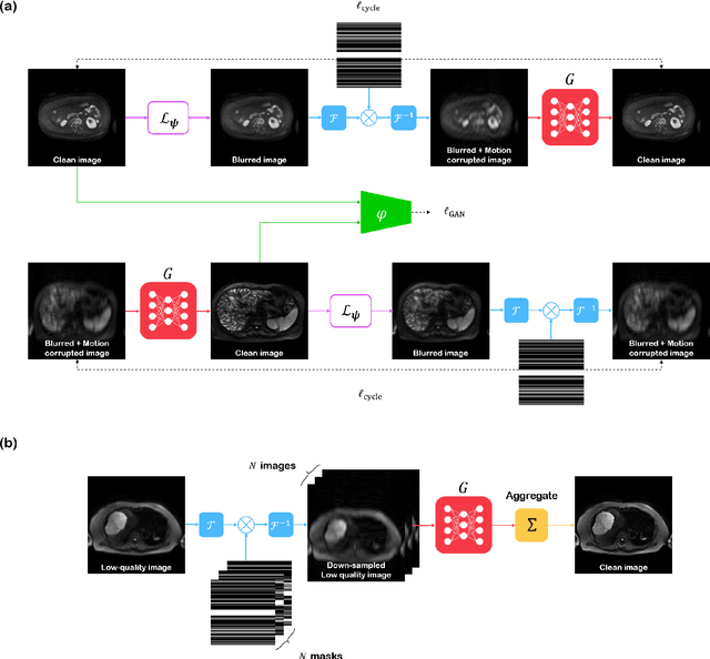 Figure 3 for Simultaneous super-resolution and motion artifact removal in diffusion-weighted MRI using unsupervised deep learning