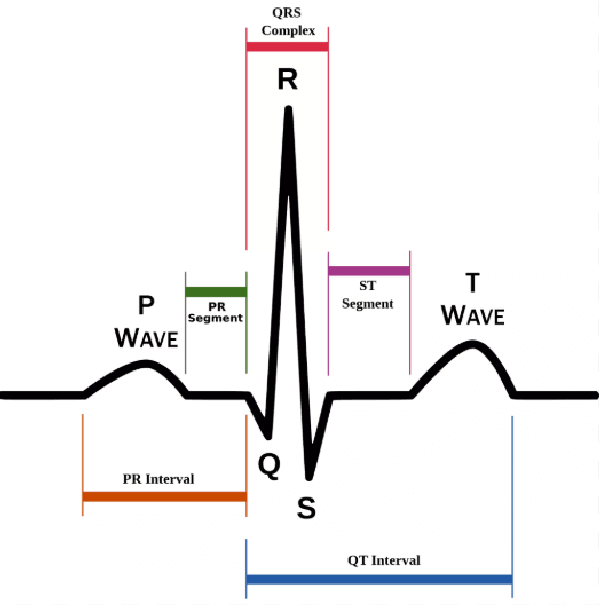 Figure 1 for A Wearable ECG Monitor for Deep Learning Based Real-Time Cardiovascular Disease Detection