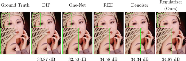 Figure 4 for Learned Gradient of a Regularizer for Plug-and-Play Gradient Descent