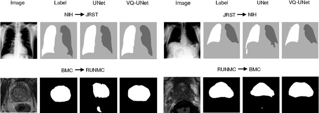 Figure 1 for Vector Quantisation for Robust Segmentation