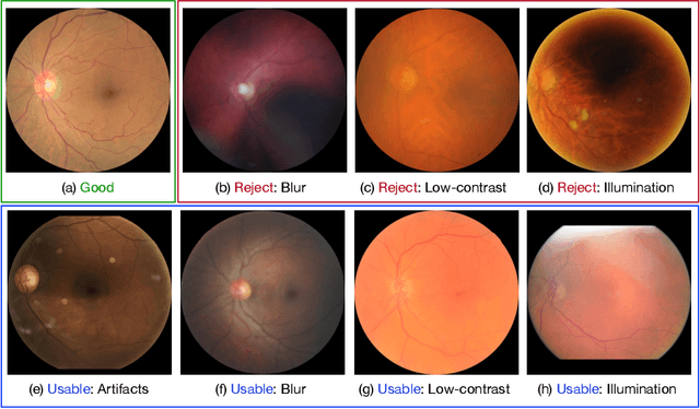 Figure 1 for Evaluation of Retinal Image Quality Assessment Networks in Different Color-spaces