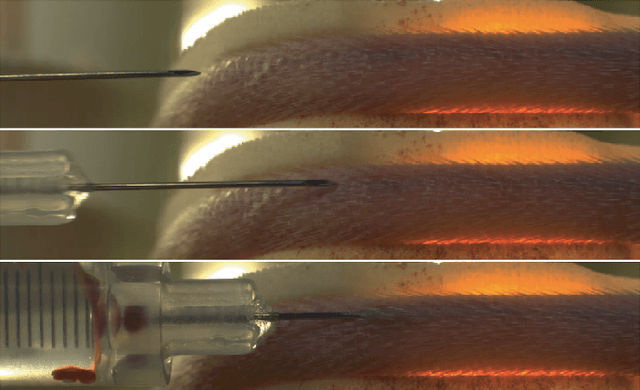 Figure 3 for Development of a Stereo-Vision Based High-Throughput Robotic System for Mouse Tail Vein Injection