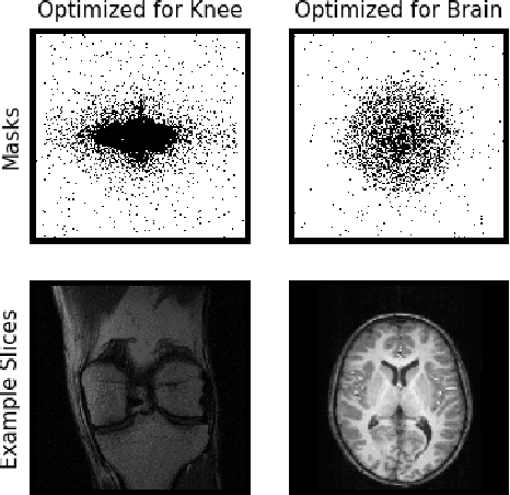 Figure 3 for Adaptive Compressed Sensing MRI with Unsupervised Learning