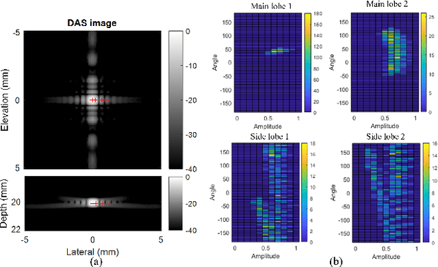 Figure 1 for 3D Super-Resolution Ultrasound with Adaptive Weight-Based Beamforming