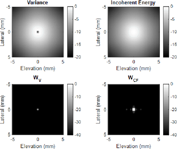 Figure 3 for 3D Super-Resolution Ultrasound with Adaptive Weight-Based Beamforming