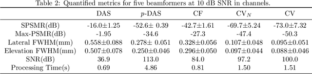 Figure 4 for 3D Super-Resolution Ultrasound with Adaptive Weight-Based Beamforming