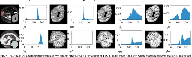 Figure 4 for Lesion classification by model-based feature extraction: A differential affine invariant model of soft tissue elasticity